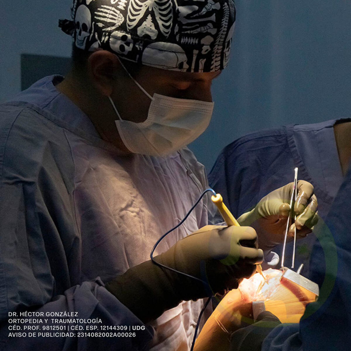 disección de la rodilla